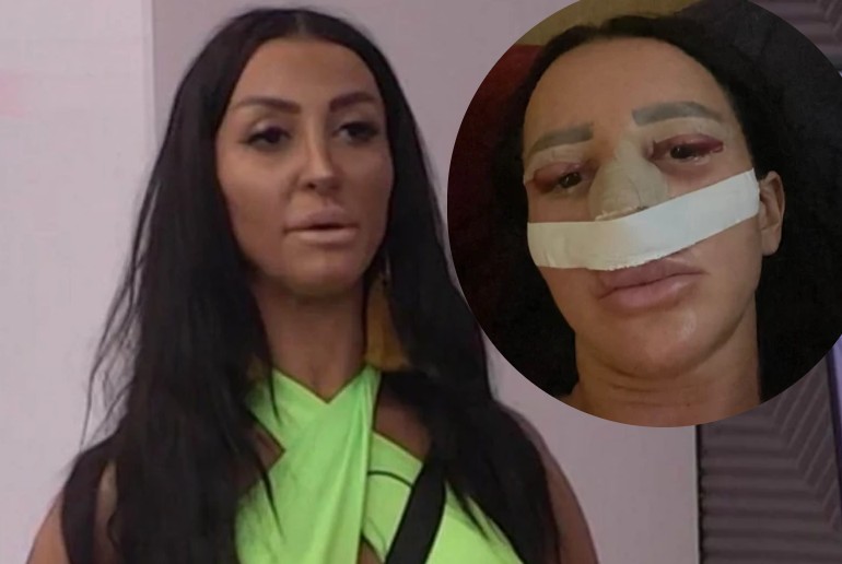 Šok potez Mitrovića: Rijaliti igračica iz bolničke postelje pravo u Elitu – jedva stoji na nogama, ali cifru nije mogla odbiti!