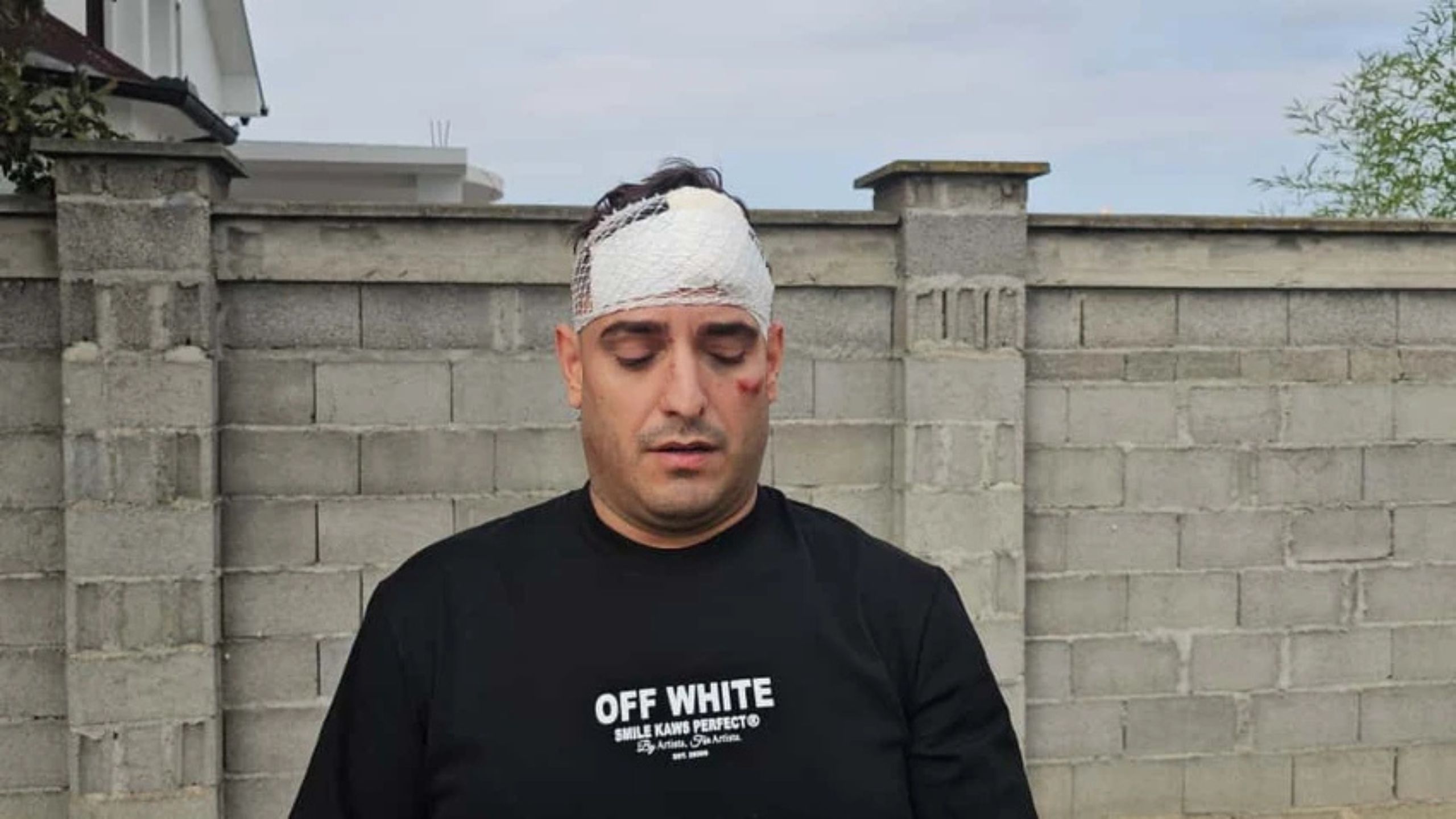 Nakon sudara s autobusom, Lazić objavio sliku s motorom – fanovi u nevjerici!