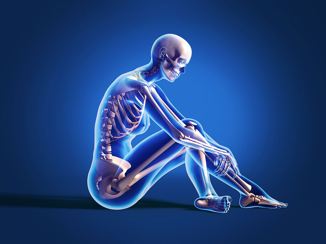 Prirodni način da ojačate kosti – bez lijekova!