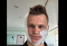 Brutalan napad u Binježevu: Muškarcu slomljena vilica na oba dijela nakon fizičkog napada u automehaničarskoj radionici Brutalan napad u Binježevu: Muškarcu slomljena vilica na oba dijela nakon fizičkog napada u automehaničarskoj radionici