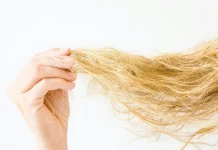 KOSA VAM SE LOMI? Možda pretjerujete s keratinom i kolagenom