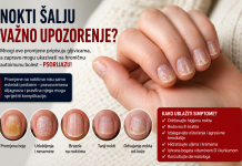 Nokti vam mijenjaju boju i pucaju? To možda nije gljivica, već znak hronične bolesti Nokti vam mijenjaju boju i pucaju? To možda nije gljivica, već znak hronične bolesti
