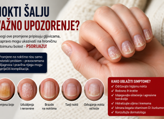 Nokti vam mijenjaju boju i pucaju? To možda nije gljivica, već znak hronične bolesti Nokti vam mijenjaju boju i pucaju? To možda nije gljivica, već znak hronične bolesti